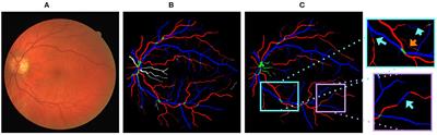 VTG-Net: A CNN Based Vessel Topology Graph Network for Retinal Artery/Vein Classification